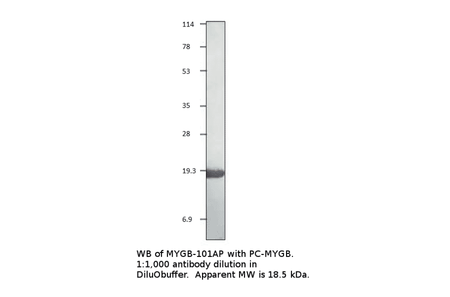 Myoglobin Positive Control from FabGennix (PC-MYGB) - Antibodies.com