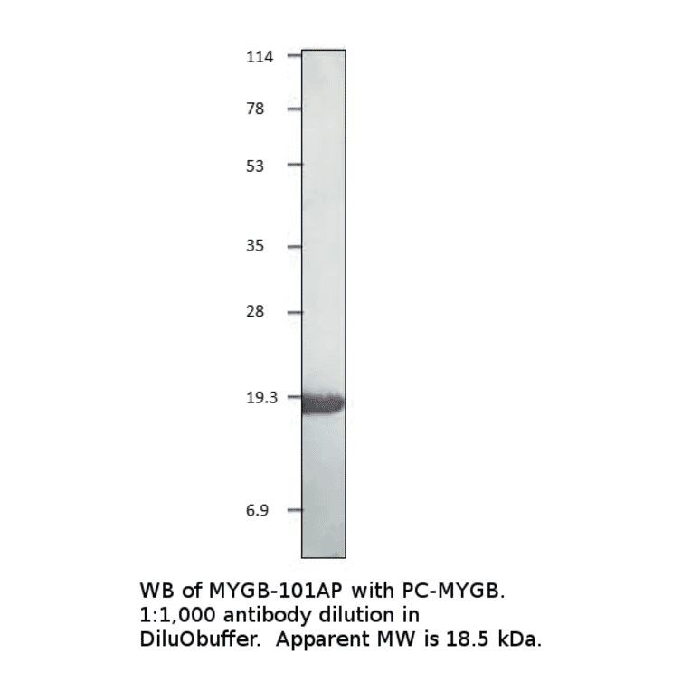 Myoglobin Positive Control from FabGennix (PC-MYGB) - Antibodies.com