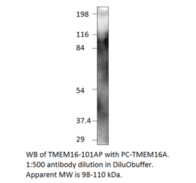 TMEM16A Positive Control from FabGennix (PC-TMEM16) - Antibodies.com