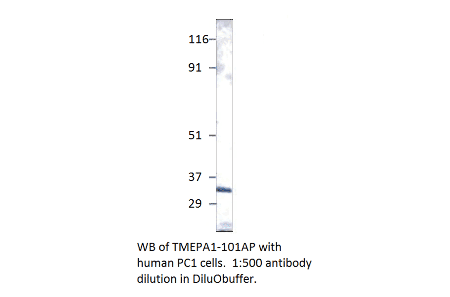 TMEPAI Positive Control from FabGennix (PC-TMEPA1) - Antibodies.com
