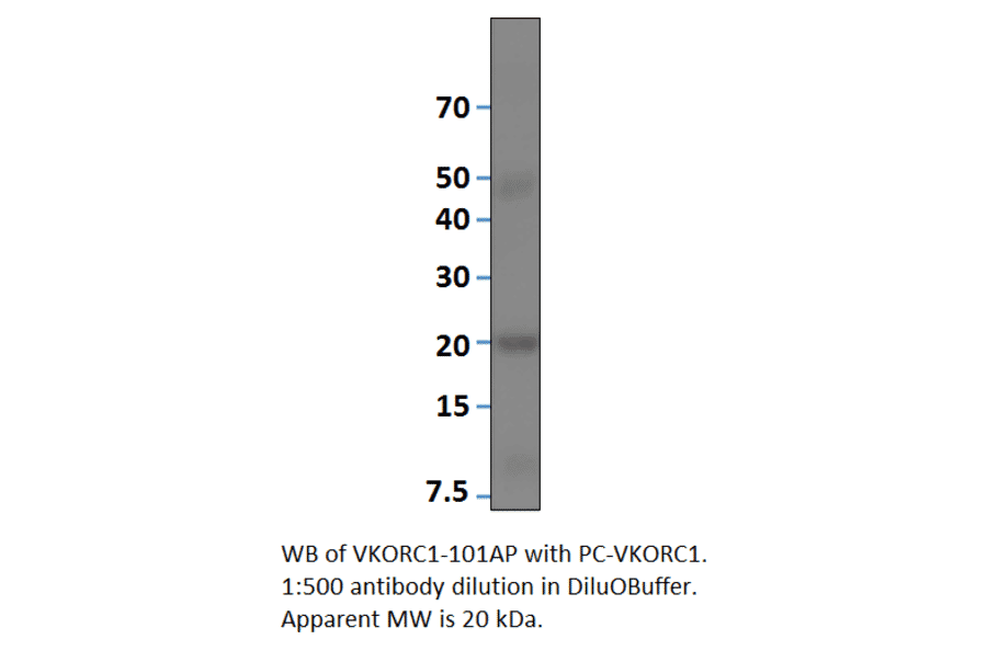 VKORC1 Positive Control from FabGennix (PC-VKORC1) - Antibodies.com