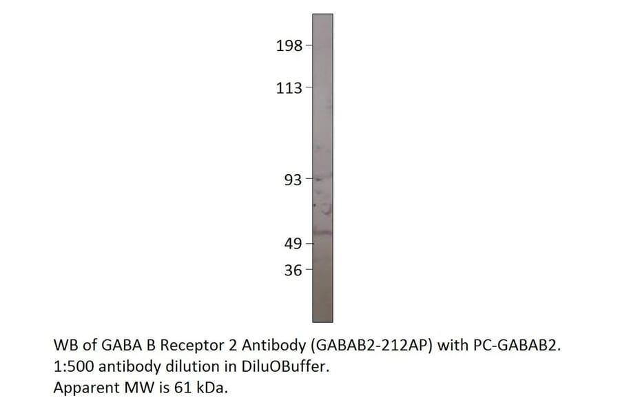 GABA B Receptor 2 Positive Control from FabGennix (PC-GABAB2) - Antibodies.com