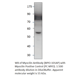 Myocilin Positive Control from FabGennix (PC-MYO) - Antibodies.com