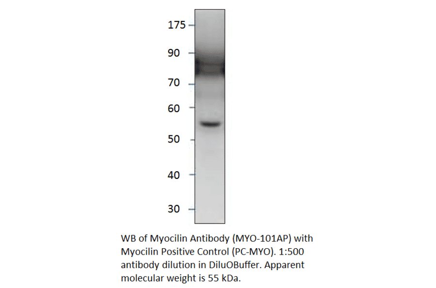 Myocilin Positive Control from FabGennix (PC-MYO) - Antibodies.com