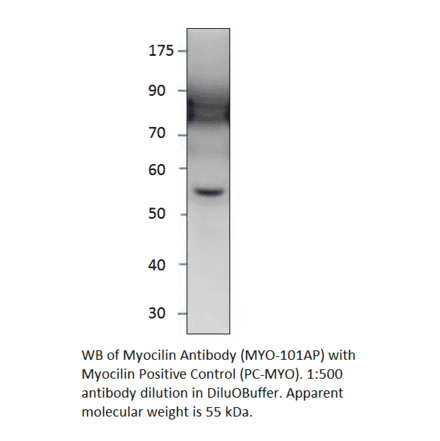 Myocilin Positive Control from FabGennix (PC-MYO) - Antibodies.com