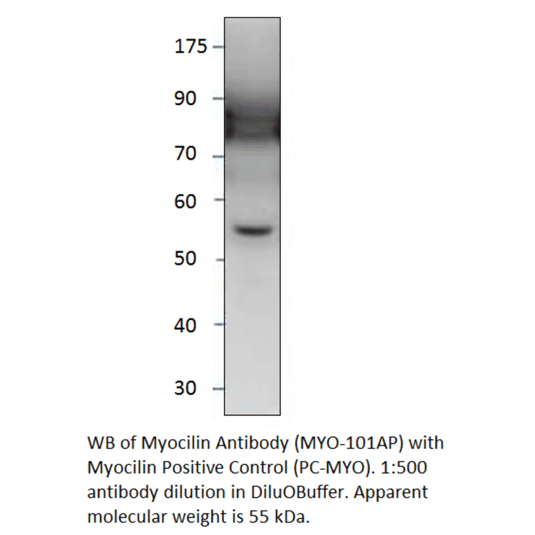Myocilin Positive Control from FabGennix (PC-MYO) - Antibodies.com
