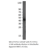 P2Y12 Positive Control from FabGennix (PC-P2Y12R) - Antibodies.com