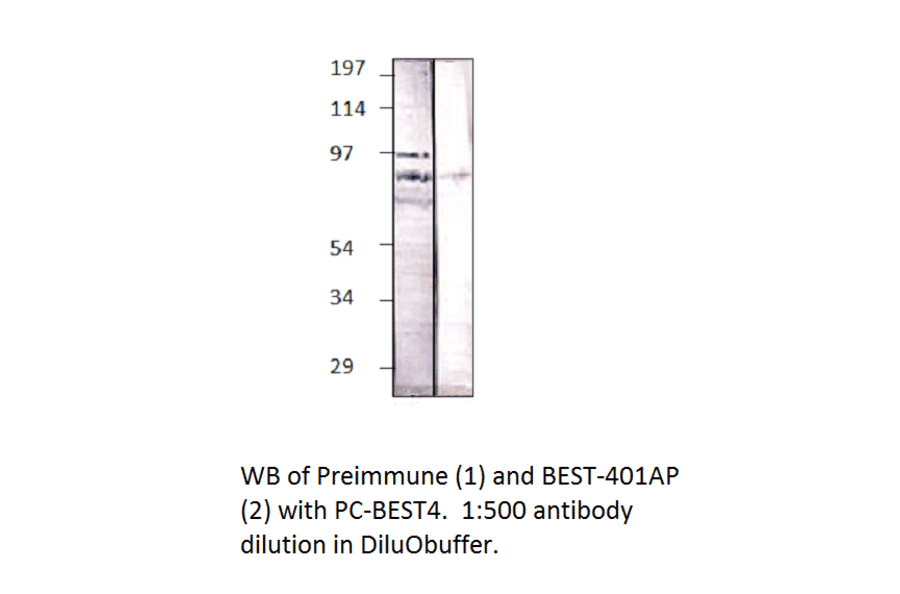 BEST4 Positive Control from FabGennix (PC-BEST4) - Antibodies.com