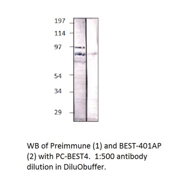 BEST4 Positive Control from FabGennix (PC-BEST4) - Antibodies.com