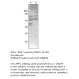 CRMP2 Positive Control from FabGennix (PC-CRMP2) - Antibodies.com