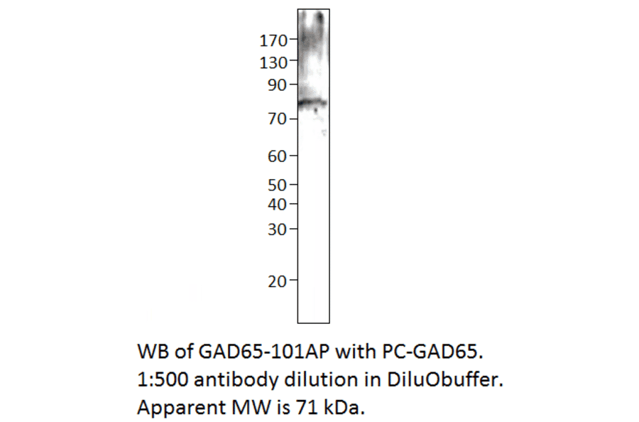 GAD65 Positive Control from FabGennix (PC-GAD65) - Antibodies.com