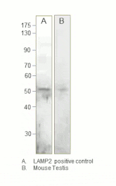 LAMP2 Positive Control from FabGennix (PC-LAMP2) - Antibodies.com