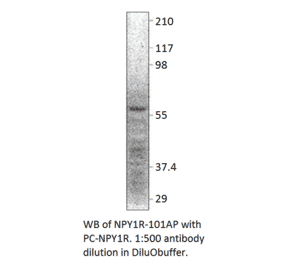 NPY1R Positive Control from FabGennix (PC-NPY1R) - Antibodies.com