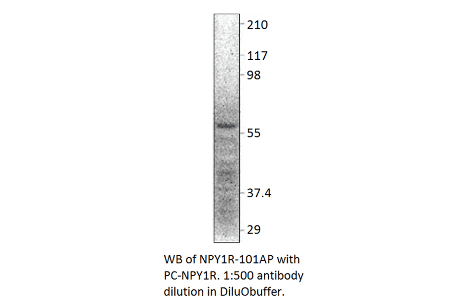 NPY1R Positive Control from FabGennix (PC-NPY1R) - Antibodies.com