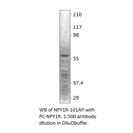 NPY1R Positive Control from FabGennix (PC-NPY1R) - Antibodies.com
