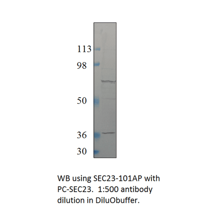 SEC23 Positive Control from FabGennix (PC-SEC23) - Antibodies.com