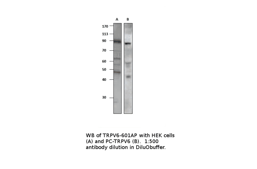 TRPV6 Positive Control from FabGennix (PC-TRPV6) - Antibodies.com