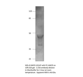 AMACR Positive Control from FabGennix (PC-AMCR) - Antibodies.com