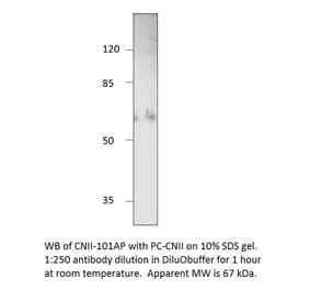 NT5C2 Positive Control from FabGennix (PC-CNII) - Antibodies.com