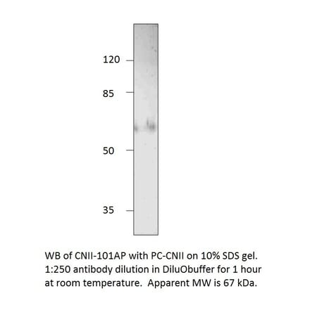 NT5C2 Positive Control from FabGennix (PC-CNII) - Antibodies.com