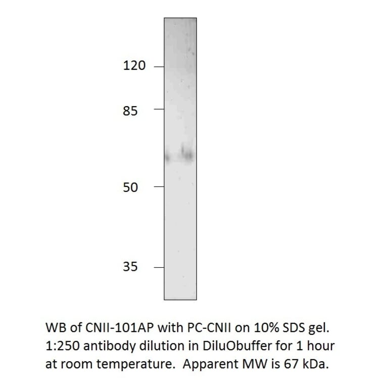 NT5C2 Positive Control from FabGennix (PC-CNII) - Antibodies.com