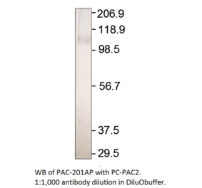 ADCY2 Positive Control from FabGennix (PC-PAC2) - Antibodies.com