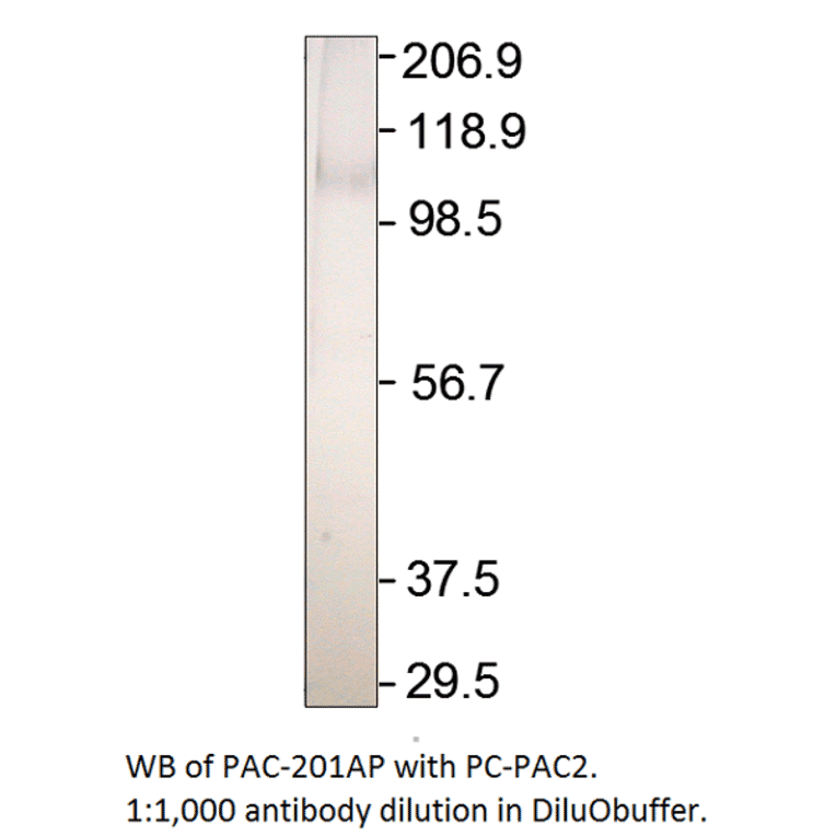 ADCY2 Positive Control from FabGennix (PC-PAC2) - Antibodies.com