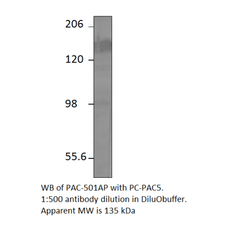 ADCY5 Positive Control from FabGennix (PC-PAC5) - Antibodies.com