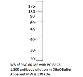 ADCY6 Positive Control from FabGennix (PC-PAC6) - Antibodies.com