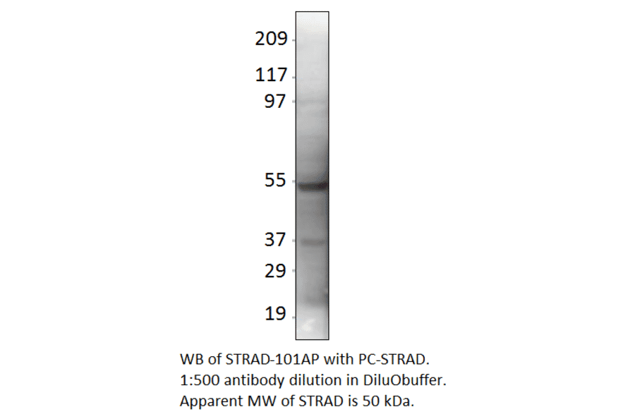 LYK5 Positive Control from FabGennix (PC-STRAD) - Antibodies.com