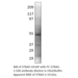 LYK5 Positive Control from FabGennix (PC-STRAD) - Antibodies.com