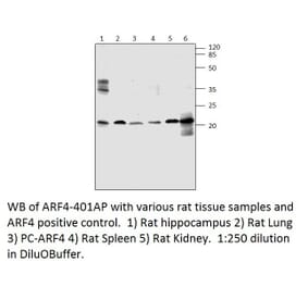ARF4 Positive Control from FabGennix (PC-ARF4) - Antibodies.com