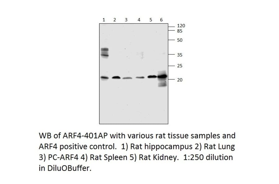 ARF4 Positive Control from FabGennix (PC-ARF4) - Antibodies.com
