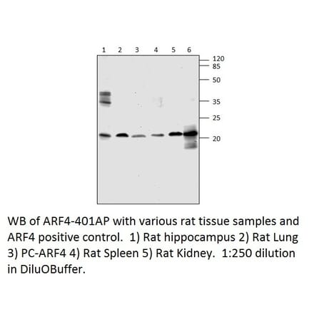 ARF4 Positive Control from FabGennix (PC-ARF4) - Antibodies.com