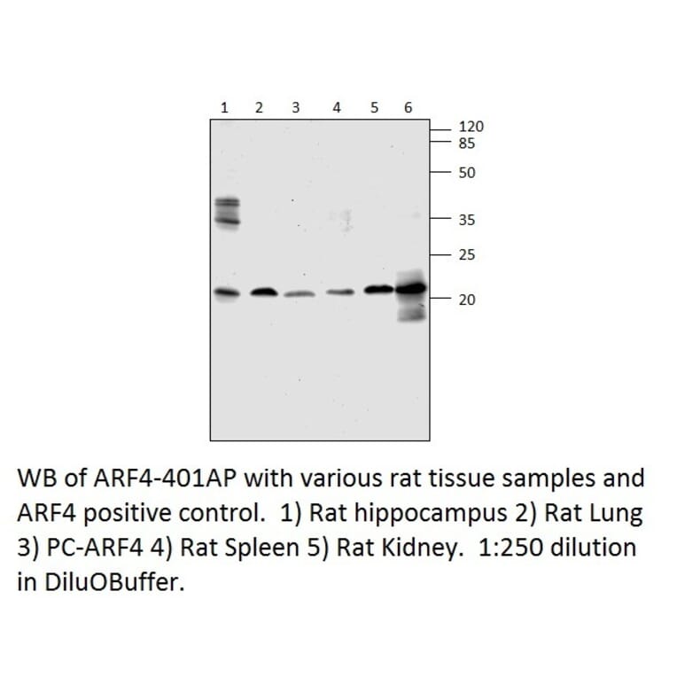 ARF4 Positive Control from FabGennix (PC-ARF4) - Antibodies.com