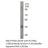 PAR2 Positive Control from FabGennix (PC-PAR2) - Antibodies.com