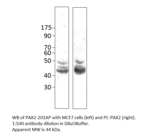 PAX2 Positive Control from FabGennix (PC-PAX2) - Antibodies.com