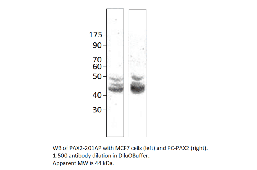 PAX2 Positive Control from FabGennix (PC-PAX2) - Antibodies.com
