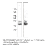 PAX2 Positive Control from FabGennix (PC-PAX2) - Antibodies.com