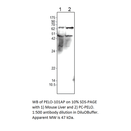 PELO Positive Control from FabGennix (PC-PELO) - Antibodies.com