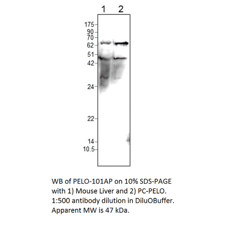 PELO Positive Control from FabGennix (PC-PELO) - Antibodies.com