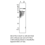 PELO Positive Control from FabGennix (PC-PELO) - Antibodies.com
