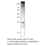 SUR1 Positive Control from FabGennix (PC-SUR1) - Antibodies.com