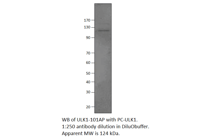 ULK1 Positive Control from FabGennix (PC-ULK1) - Antibodies.com