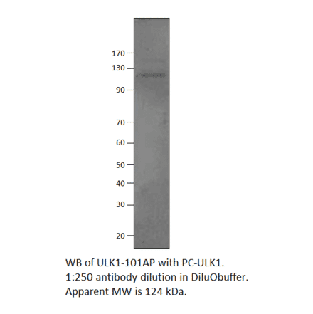 ULK1 Positive Control from FabGennix (PC-ULK1) - Antibodies.com