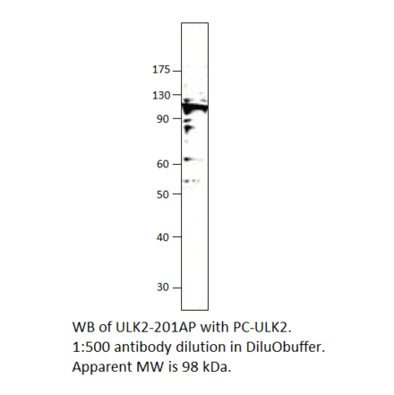 ULK2 Positive Control from FabGennix (PC-ULK2) - Antibodies.com