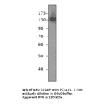 Axl Positive Control from FabGennix (PC-AXL) - Antibodies.com