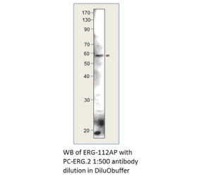 ERG Positive Control from FabGennix (PC-ERG) - Antibodies.com