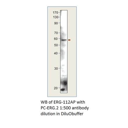 ERG Positive Control from FabGennix (PC-ERG) - Antibodies.com