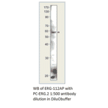 ERG Positive Control from FabGennix (PC-ERG) - Antibodies.com